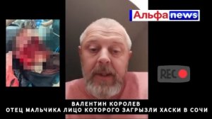Отец девятилетнего мальчика, пострадавшего от нападе?