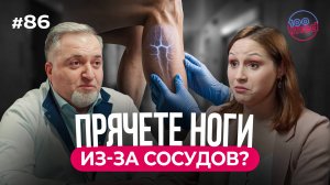 Стесняетесь Сосудов на Ногах? | Как Удалить Эти Сосудистые Звёздочки и Избежать Варикоза?