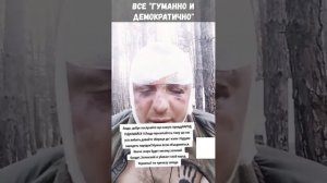 Бандеры ищут только себе подобных, а всех остальных они пускают на мясо или превращают в инвалидов