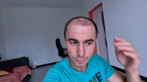 Месяц После Пересадки Волос