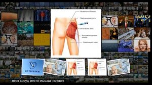 Почему большинство уколов делают в ягодицу masterok