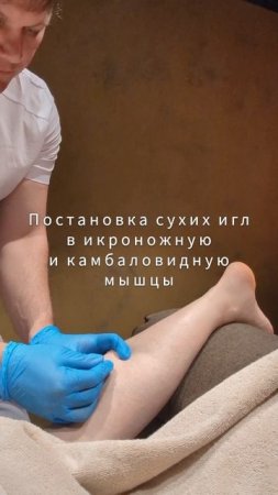 СУХИЕ ИГЛЫ 💉 АКУПУНКТУРА 💉 ИГЛОУКАЛЫВАНИЕ