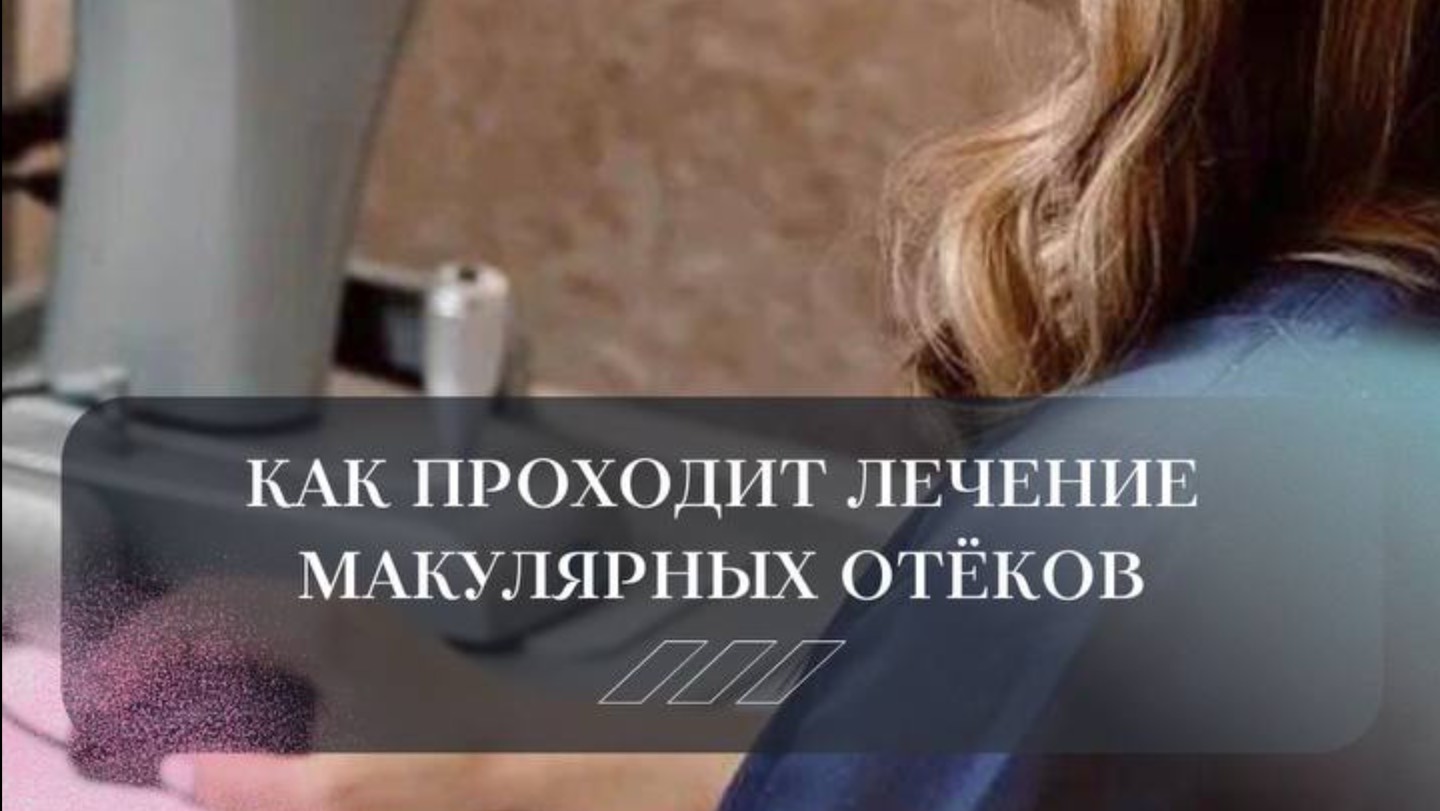 Как проходит лечение макулярных отеков?