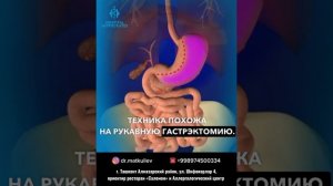 Метаболическая операция на сахарный диабет 2 тип #саха