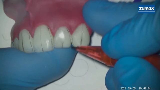 полировка виниры смотреть онлайн