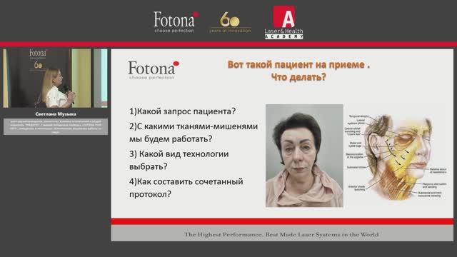 Фототермическая реконструкция тканей. Альтернатива операции пациентов с 3-4 ст. птоза. Музыка С. А.