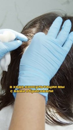 как соблюсти естественный угол роста волос при пересадке