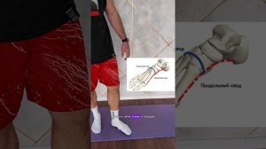 Упражнение от плоскостопия. Вальгус. Упражнения для стопы. Врач Ерастов Евгений. #топыкатегорий