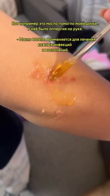 Масло ним (neem oil) — это растительное масло, получаемое ? смотреть онлайн