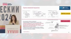 Постнеоадъювантное лечение раннего РМЖ. Морфологическая оценка ответа на НАЛТ