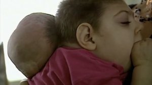 Дети мутанты Чернобыля