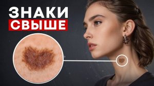 Эти УГРОЖАЮЩИЕ метки на теле! / Что означают родимые пятна?