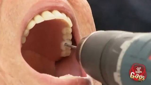 Телерозыгрыш Уличный дантист