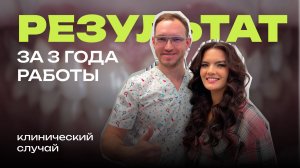 Элайнеры 3 года. Имплантация, отбеливание зубов. Результат ТОП. Стас Белоус Стоматолог Ульяновск