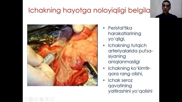 Қорин чурралари асоратлари