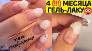 Почему НЕЛЬЗЯ перенашивать ГЕЛЬ ЛАК!!! Маникюру 4 месяца 😵 Дизайн ногтей