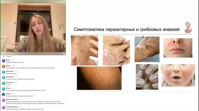 Вы постоянно болеете из-за паразитов!  Хронический паразитоз у детей и взрослых