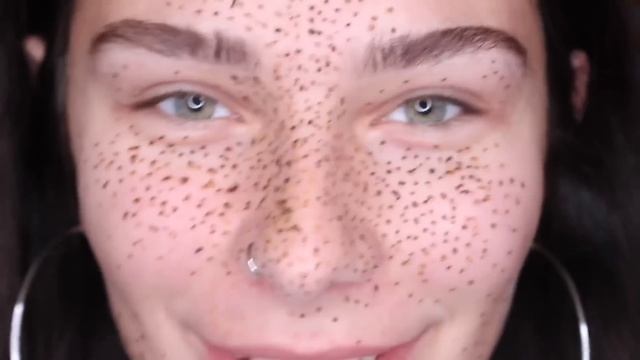 ВЕСНУШКИ ХНОЙ