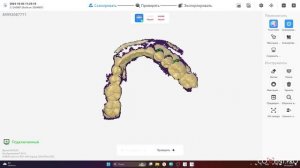 Интраоральный сканер до 500К: Тестируем Upcera в действии!