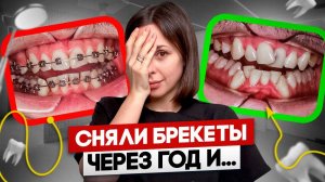 Не совершай эту ОШИБКУ! За какое ВРЕМЯ можно исправить прикус?