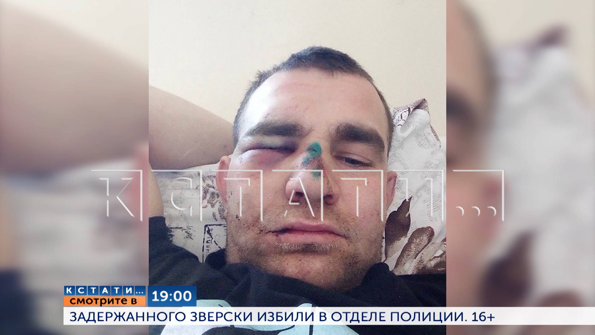 Смотрите сегодня в 19.00 в программе "Кстати": Задержанного зверски избили в отделе полиции