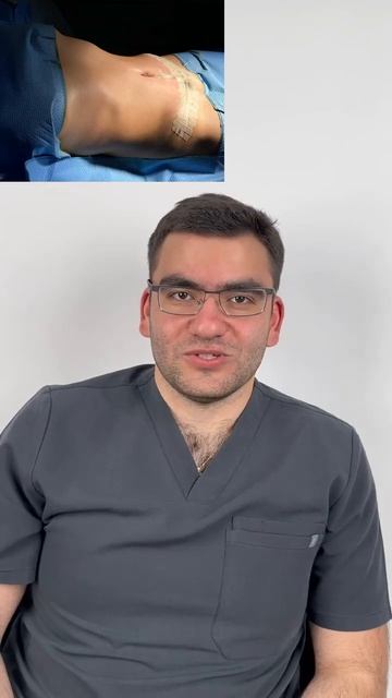 Абдоминопластика | Тевосян Артур Арсенович | Клиника смотреть онлайн