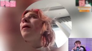 КАША СМОТРИТ- СПЛИТИКА ХАЙПИТ НА БОЛЕЗНИ?