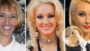 Не узнать! Что Лера Кудрявцева сделала с лицом? Разбор