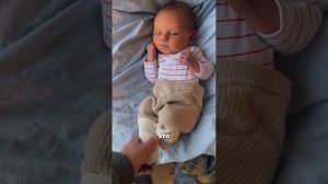 5 тревожных признаков желтухи у новорожденного