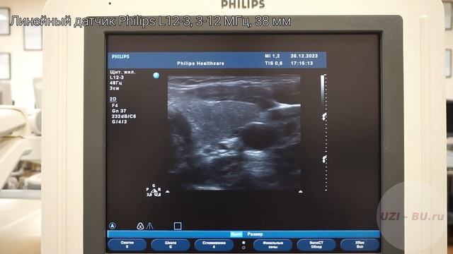 Philips HD11 XE обзор ультразвукового сканера смотреть онлайн