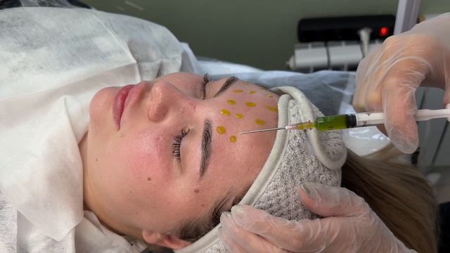 Пилинг БиоРеПил BioRePeelCl3 . Раскрываем секреты с космето? смотреть онлайн