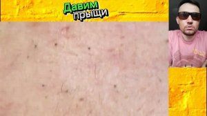 ЗАСАЛЕННЫЕ пора №3