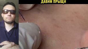 СОЧНАЯ работа косметолога №7