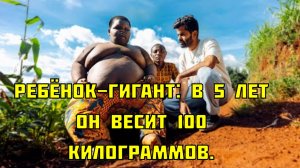 Ребёнок-гигант: в 5 лет он весит 100 килограммов.