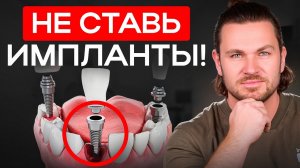 СКРЫТЫЕ РИСКИ установки ИМПЛАНТОВ, которые нельзя игнорировать!