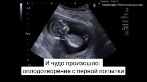 «Часики-то тикают». 31-летняя женщина, не найдя идеального мужа, стала мамой искусственным путем
