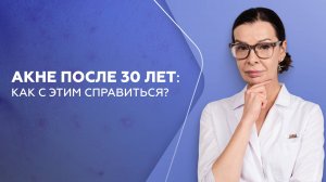 Как справиться с акне после 30 лет?