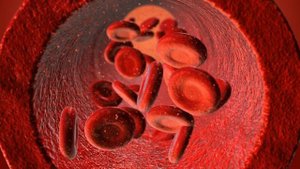 Как наладить желчеотток и убрать застой желчи в желчн?