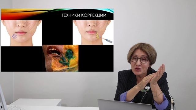 Бьюти-тренды. Коррекция овала лица в технике Full-Face + бонус!