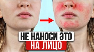 СПАСИ СВОЮ КОЖУ! Как побороть зависимость от гормональных мазей БЕЗ ПОСЛЕДСТВИЙ?