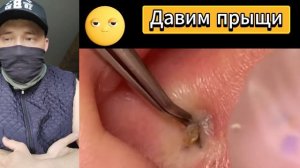 ОЧЕНЬ МНОГО САЛА №20