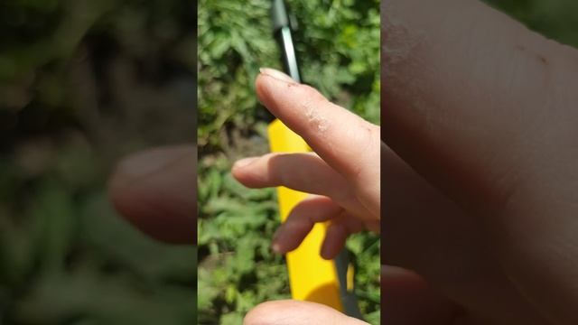 Кнопка на триммере сдирает кожу на пальце смотреть онлайн