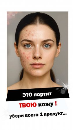 Избавься от прыщей раз и навсегда