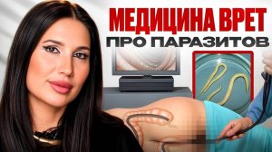 Разбираем мифы о паразитах