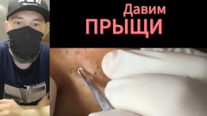 ТАКИЕ ПРЫЩИ встречаются редко №22