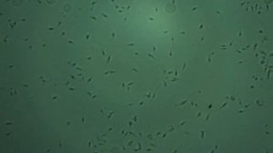 Воспаление