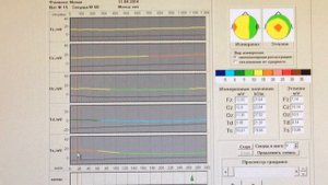Гипноз.Изменение энергетики мозга в гипнозе. gipnos.ru ГИП
