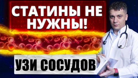 НУЖНЫ ЛИ СТАТИНЫ?! УЗНАЙ ПО УЗИ СОСУДОВ ШЕИ - БРАХИОЦЕФАЛЬНЫХ АРТЕРИЙ!