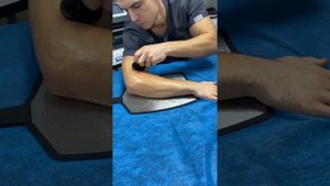 Армрестлинг. Восстановление локтевого сустава текар ?