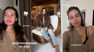 ВЛОГ: Удаляю ВСЕ Зубы Мудрости Под Седацией / Мой Опыт